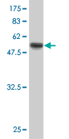 1 - PPP1R2P3 Antibody (monoclonal) (M01) AT3410a