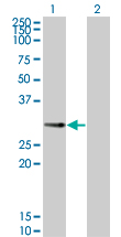 1 - PPP1R2P3 Antibody (monoclonal) (M01) AT3410a