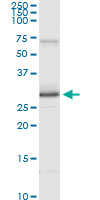 5 - PRDX3 Antibody (monoclonal) (M01) AT3422a