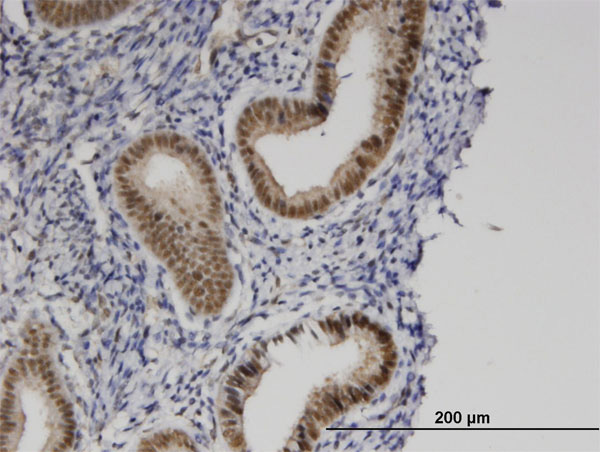 2 - PRKCBP1 Antibody (monoclonal) (M01) AT3432a