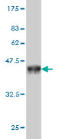 1 - PRKCBP1 Antibody (monoclonal) (M01) AT3432a
