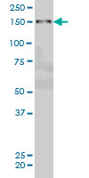 1 - PRKCBP1 Antibody (monoclonal) (M01) AT3432a