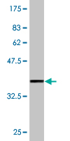 1 - PRKCBP1 Antibody (monoclonal) (M06) AT3433a