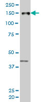 1 - PRKCBP1 Antibody (monoclonal) (M06) AT3433a