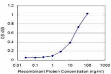 10 - PRKRIP1 Antibody (monoclonal) (M05) AT3435a
