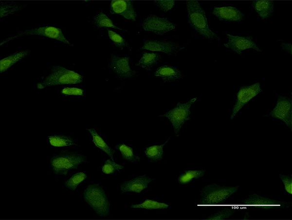 3 - PRKRIP1 Antibody (monoclonal) (M05) AT3435a