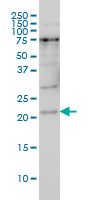 1 - PRKRIP1 Antibody (monoclonal) (M05) AT3435a