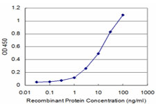 10 - PRKRIP1 Antibody (monoclonal) (M07) AT3436a