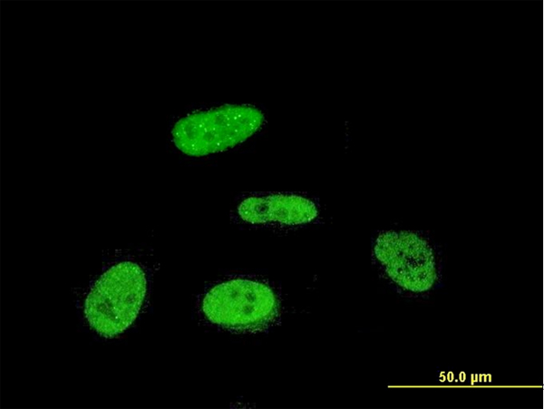 3 - PRKRIP1 Antibody (monoclonal) (M07) AT3436a