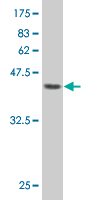 1 - PRKRIP1 Antibody (monoclonal) (M07) AT3436a