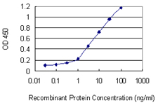 10 - PRRX2 Antibody (monoclonal) (M01) AT3445a