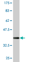 1 - PRRX2 Antibody (monoclonal) (M01) AT3445a
