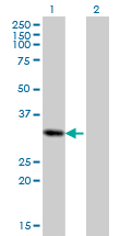 1 - PRRX2 Antibody (monoclonal) (M01) AT3445a