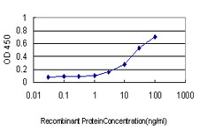 10 - PSCD1 Antibody (monoclonal) (M01) AT3449a