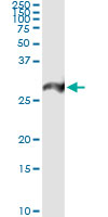 5 - PSMA7 Antibody (monoclonal) (M01) AT3455a
