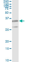 5 - PSMB8 Antibody (monoclonal) (M01) AT3463a