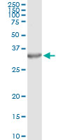 5 - PSME2 Antibody (monoclonal) (M02) AT3475a
