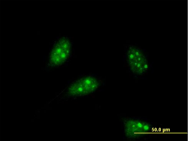 3 - PTF1A Antibody (monoclonal) (M05) AT3481a