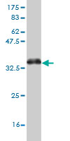 1 - PTF1A Antibody (monoclonal) (M05) AT3481a
