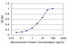 10 - PTF1A Antibody (monoclonal) (M09) AT3482a
