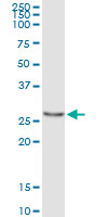 5 - PYCRL Antibody (monoclonal) (M01) AT3505a