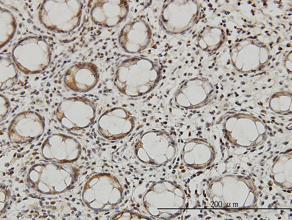 2 - QARS Antibody (monoclonal) (M01) AT3506a