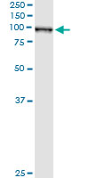 5 - QARS Antibody (monoclonal) (M01) AT3506a