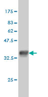 1 - QARS Antibody (monoclonal) (M01) AT3506a