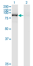 1 - QARS Antibody (monoclonal) (M01) AT3506a