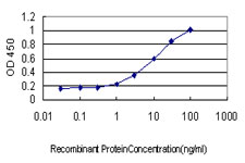 10 - QARS Antibody (monoclonal) (M01) AT3506a