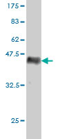 1 - RAB15 Antibody (monoclonal) (M01) AT3511a