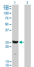 1 - RAB15 Antibody (monoclonal) (M01) AT3511a