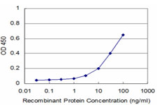 10 - RAB17 Antibody (monoclonal) (M01) AT3512a