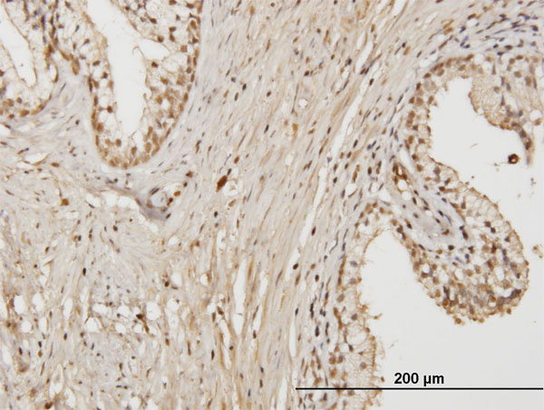 2 - RAB17 Antibody (monoclonal) (M01) AT3512a