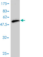 1 - RAB17 Antibody (monoclonal) (M01) AT3512a