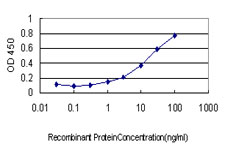 10 - RAB17 Antibody (monoclonal) (M05) AT3513a