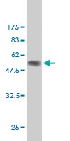 1 - RAB17 Antibody (monoclonal) (M05) AT3513a