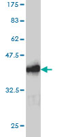 1 - RAB26 Antibody (monoclonal) (M01) AT3516a
