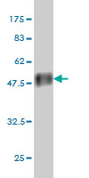 1 - RAB33A Antibody (monoclonal) (M04) AT3520a