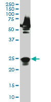 1 - RAB33A Antibody (monoclonal) (M04) AT3520a
