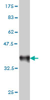 1 - RAB33B Antibody (monoclonal) (M01) AT3521a