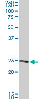 1 - RAB33B Antibody (monoclonal) (M01) AT3521a