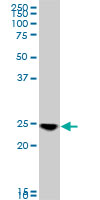 1 - RAB33B Antibody (monoclonal) (M01) AT3521a