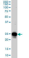 1 - RAB33B Antibody (monoclonal) (M01) AT3521a