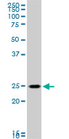 1 - RAB33B Antibody (monoclonal) (M01) AT3521a