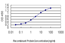 10 - RAB33B Antibody (monoclonal) (M01) AT3521a
