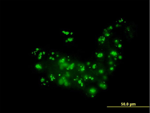 3 - RAB36 Antibody (monoclonal) (M01) AT3522a