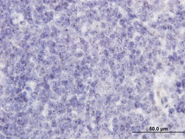2 - RAB36 Antibody (monoclonal) (M01) AT3522a