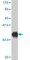 1 - RAB36 Antibody (monoclonal) (M01) AT3522a