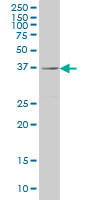 1 - RAB36 Antibody (monoclonal) (M01) AT3522a
